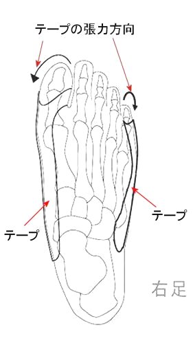 ハルデージが足指を開く仕組みです。